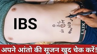 अपना IBS खुद चेक करें  रूपये बरबाद करने से बचें  Neurotherapy treatment for IBS  neurotherapy [upl. by Radu]