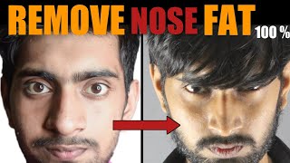 Mote Naak Ko Patla Karne Ka Tarika हिंदी How To REMOVE Nose Fat  100 Slim  Sharp Big Nose [upl. by Ennaecarg23]