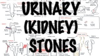 UrinaryKidney Stones  Overview signs and symptoms risk factors pathophysiology treatment [upl. by Stempien]