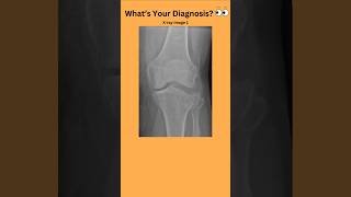 Whats Your Diagnosis 👀radiology radiography doctor nurse medicalstudent medicaltest [upl. by Rusell]