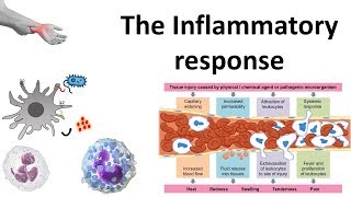 The Inflammatory response [upl. by Lindell]