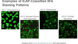 Antinuclear Antibody Testing [upl. by Manton276]