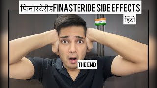 हिंदी Finasteride Side Effects Finasteride Before and after FINASTERIDE Results Hairloss Hindi [upl. by Hubing20]