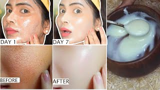 रात में ऐसे लगाए GLYCERINlarge pores दाग धब्बे कालापन होगा दूरमिलेगी टाइट निखरी चमकदार GLASS SKIN [upl. by Delanie]