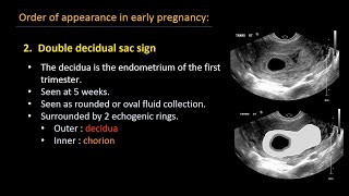 Ultrasound of normal early pregnancy [upl. by Felizio]