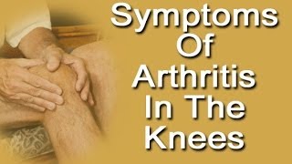 Symptoms Of Arthritis In Knees [upl. by Nirra]