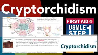 Cryptorchidism in HindiUrdu by first aid for USMLE step 1 [upl. by Thgiwd522]