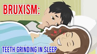 Bruxism Teeth grinding in sleep [upl. by Brenna753]