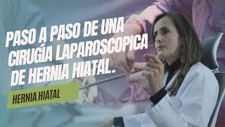 Descripción del paso a paso de una cirugía laparoscópica de hernia hiatal [upl. by Minna]