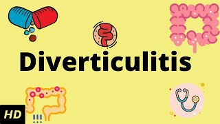 Diverticulitis Causes SIgns and Symptoms Diagnosis and Treatment [upl. by Adekahs]