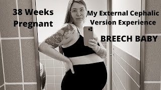 My External Cephalic Version Experience  Breech baby  38 weeks pregnant [upl. by Ahscrop934]