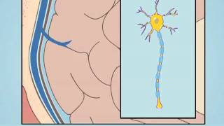 Understanding Diffuse Axonal Injury [upl. by Wetzell]