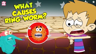 What Causes Ringworms  Skin Infection  The Dr Binocs Show  Peekaboo Kidz [upl. by Egwan]