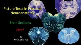 Picture Test in Neuroanatomy Brain Sections 7 [upl. by Mireille92]