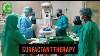 Surfactant administration of a premature babyA easiest way in NICU [upl. by Rafaello]