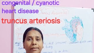 congenital cyanotic heart disease truncus arteriosis class in tamil [upl. by Scharaga]