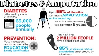 Talking About Diabetes amp Amputation [upl. by Chessy]