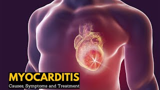 Myocarditis Causes Signs and Symptoms Diagnosis Treatment [upl. by Anoirtac280]