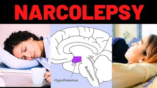 What is Narcolepsy Symptoms Causes Treatment [upl. by Noffets401]