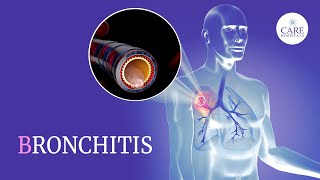 Know About Bronchitis Types Causes Symptoms Treatment And Prevention  CARE Hospitals [upl. by Sandro]