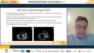 74 Devices for transcatheter closure of ASDPFO and LAA Similarities and differences [upl. by Eityak]