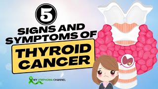 5 Important Signs and Symptoms of Thyroid Cancer That You Shouldnt Ignore [upl. by Bonnell]