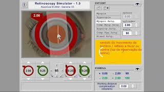 VÍDEO 2  Retinoscopia técnica por esferas [upl. by Boyes]
