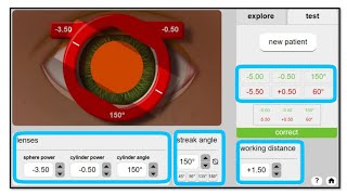 Retinoscopy Simulator Practice Retinoscopy with Simulator [upl. by Ama]