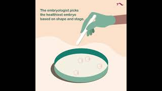 Choosing The Perfect Embryo For IVF The Selection Process Unveiled novaivf ivflab ivfcenter ET [upl. by Elledoj]