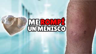 ME ROMPI UN MENISCO  MI EXPERIENCIA CON ARTROSCOPIA CIRUGIA DE RODILLA Y RECUPERACION [upl. by Nahtanod675]