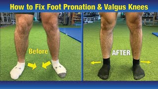 VERY EFFECTIVE Way to FIX Pronated feet amp Knees Caving In Valgus Knees [upl. by Vivl303]