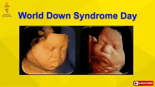 World Down Syndrome Day [upl. by Jaan]