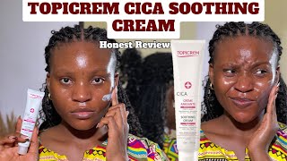 ALL YOU NEED TO KNOW ABOUT THE TOPICREM CICA SOOTHING CREAM  SKIN SENSITIVITY [upl. by Lezti664]