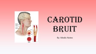 Carotid bruit  causes pathophysiology sign value [upl. by Misab]