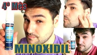 Minoxidil 5 Kirkland  4º mês de uso No cabelo Como aplicar na barba  cabelo e sobrancelha [upl. by Kinny]