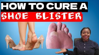 3 Awesome Steps To Cure A Blister on The Feet [upl. by Noland]