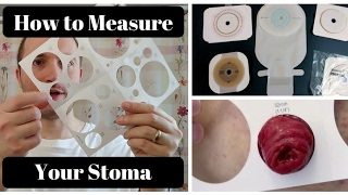 How to Measure Your Stoma OSTOMY TIPS [upl. by Ahseekat]