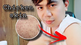 Proven EFFECTIVE to minimize CHICKEN SKIN  Nurse tips [upl. by Zashin]