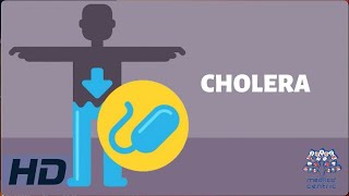 CHOLERA Everything You Need To Know [upl. by Netsryk]