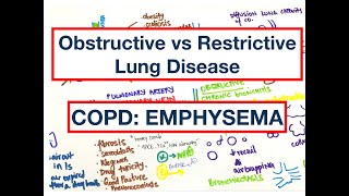 Obstructive vs Restrictive Lung Disease  COPD Emphysema  DLCO FEV1FVC Compliance  MCQ  USMLE [upl. by Esilenna66]