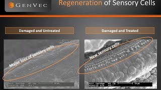 CGF166 Inner Ear Gene Therapy Trial  Corp Presentation  December 2015 [upl. by Noremak]