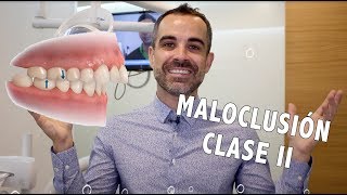 Tooth Boss  Maloclusión clase II  Ortodoncia en Murcia [upl. by Cramer]