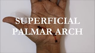 Surface marking of Superficial Palmar Arch [upl. by Psyche946]