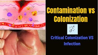 contamination vs colonization vs critical colonization vs infection  PhysiotherapyKnowledge [upl. by Yssac]