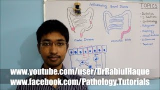 Inflammatory Bowel Disease HD [upl. by Mylander416]