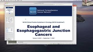 Surgical Approaches to Esophageal Cancer [upl. by Tommi]