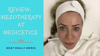 Review of Mesotherapy treatment at Medicetics clinic [upl. by Tiphanie]