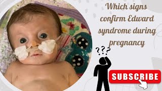 Edward syndrome  trisomy 18 signs on ultrasound Part 1 [upl. by Yenffad]