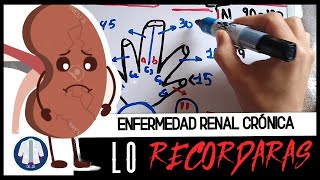 KDIGO ¿CÓMO RECORDARLO Clasificación de enfermedad renal crónica Explicado Dr JR [upl. by Aloap906]