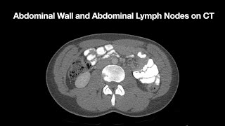 Anatomy of the Abdominal Wall and Abdominal Lymph Node Stations [upl. by Lanos]